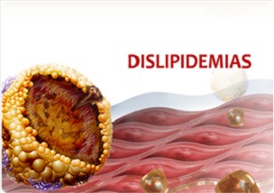 Jornada de Actualización de Dislipemia